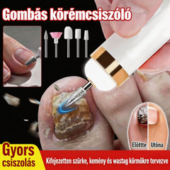 🦶🦶 Elektromos körömreszelő gombagombára, egy kis elektromos körömreszelő.
