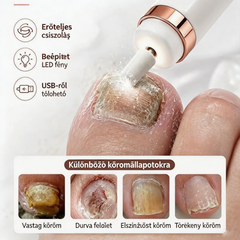 🦶🦶 Elektromos körömreszelő gombagombára, egy kis elektromos körömreszelő.